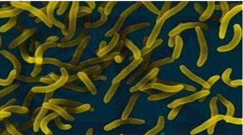 微生物菌劑好？好在哪里您知道嗎？